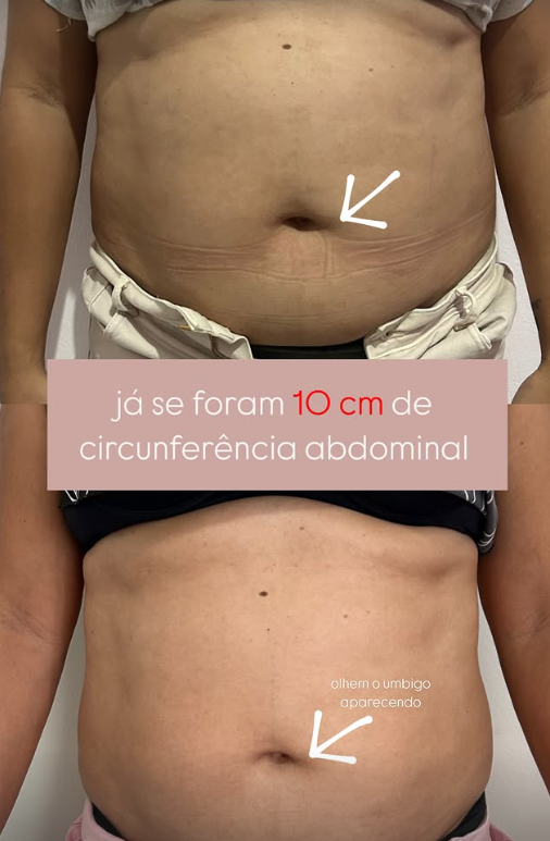 Depoimento de cliente 1